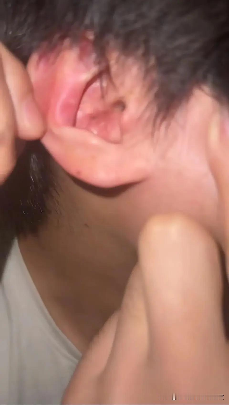 河南郑州一大二学生，凌晨1点戴蓝牙耳机刷视频准备睡，突然"嘭"一声——耳机在耳道