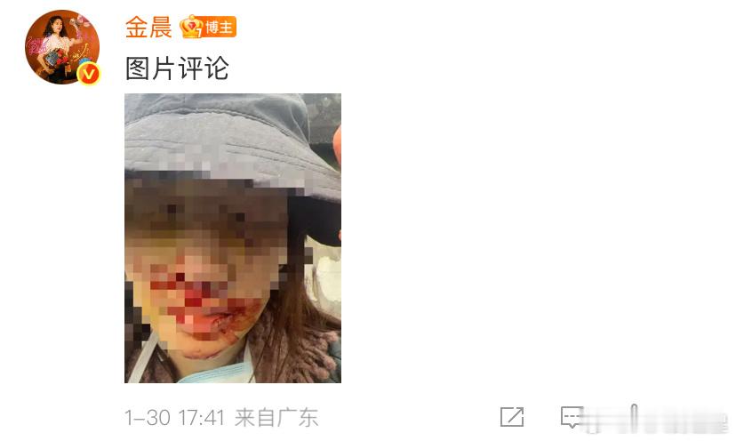 天啊 原来当时的事故这么严重金晨回应肇事逃逸争议金晨发文回应肇事逃逸争议