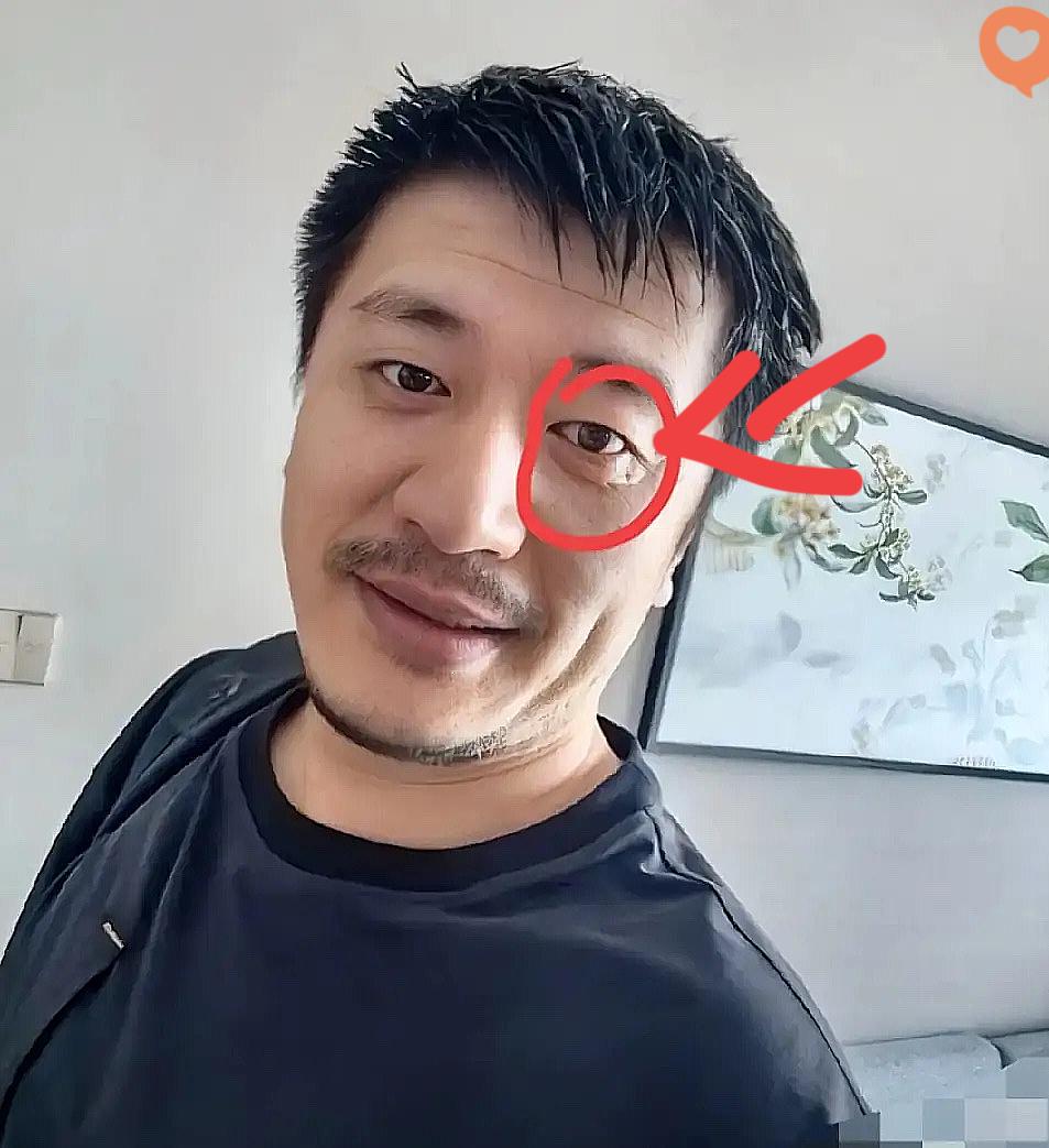 越想张雪峰这事越有个解不开的疑点！
身边有专业护理团队保驾护航，按说身体早该被照