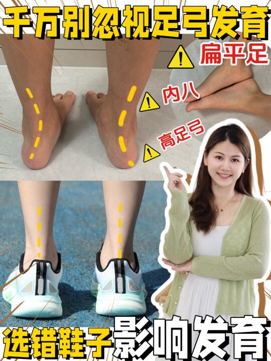 孩子的足弓健康、你真的重视了吗⁉️