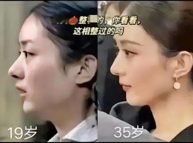 赵丽颖19岁和35岁相比，后面越来越好看了，不比不知道，一比吓一跳。确实眼睛也大