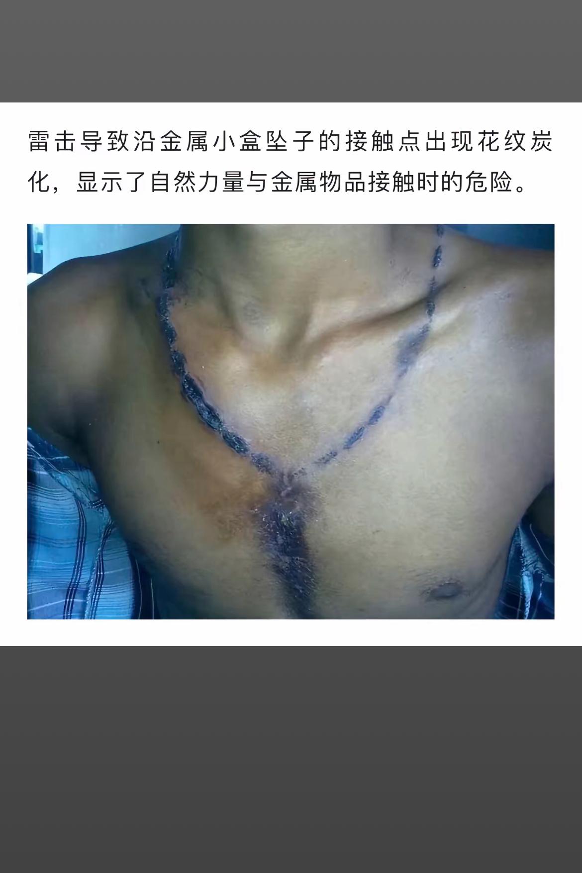 雷击后金属小盒接触点出现花纹炭化，自然力量与金属接触的危险！