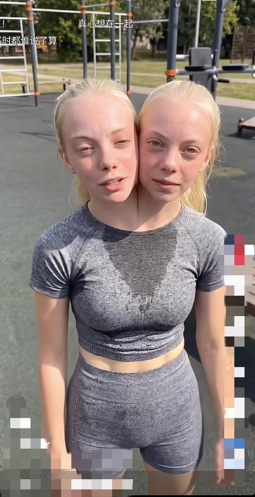 连体人是怎么产生的？