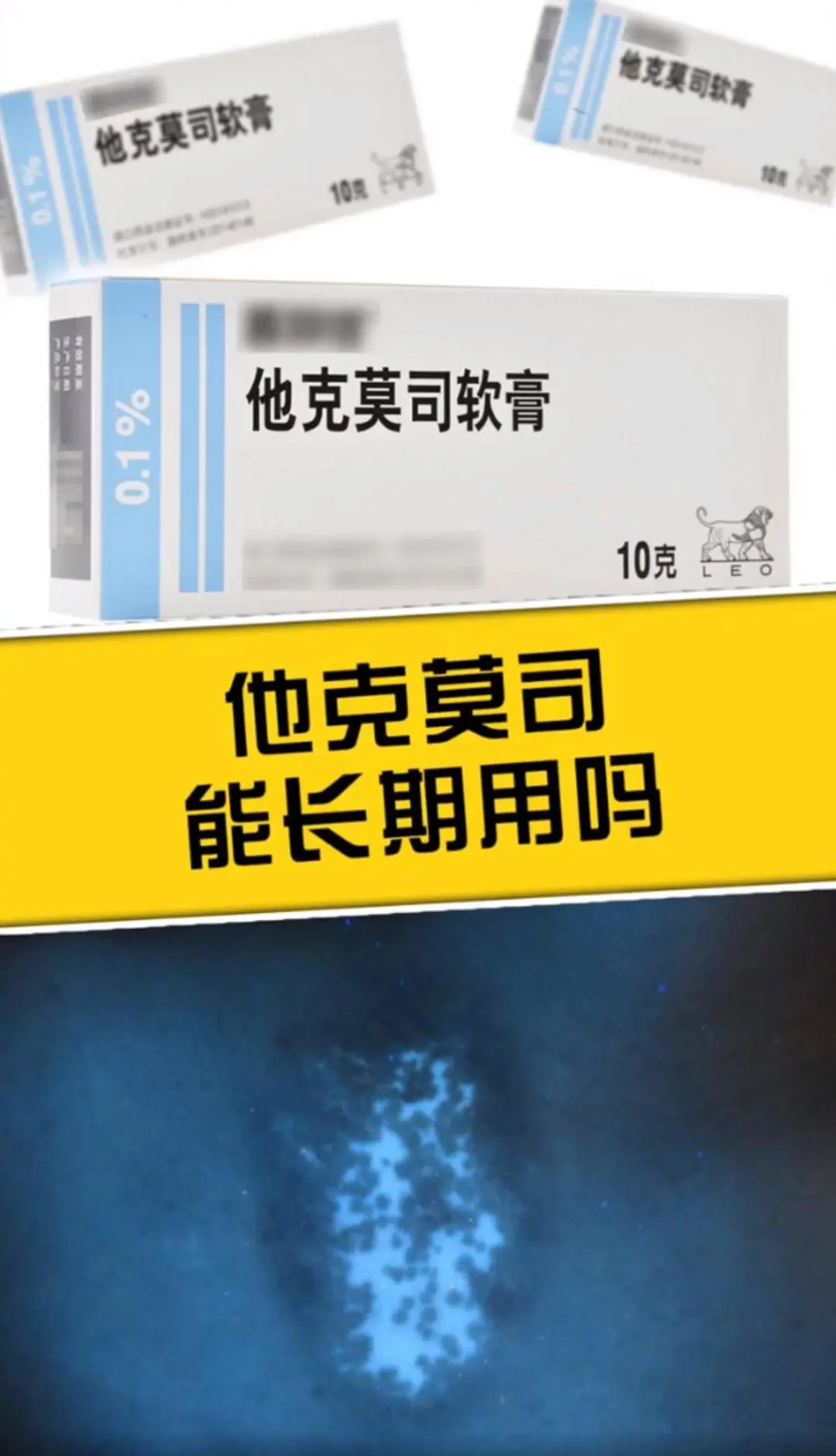 以下是关于长期使用他克莫司软膏的关键信息：  1、使用时间：他克莫司软...