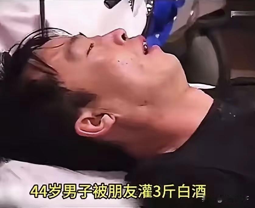 三斤白酒送进ICU，手术7小时捡回命，却留下一辈子的痛！
 
44岁男子赴一场同