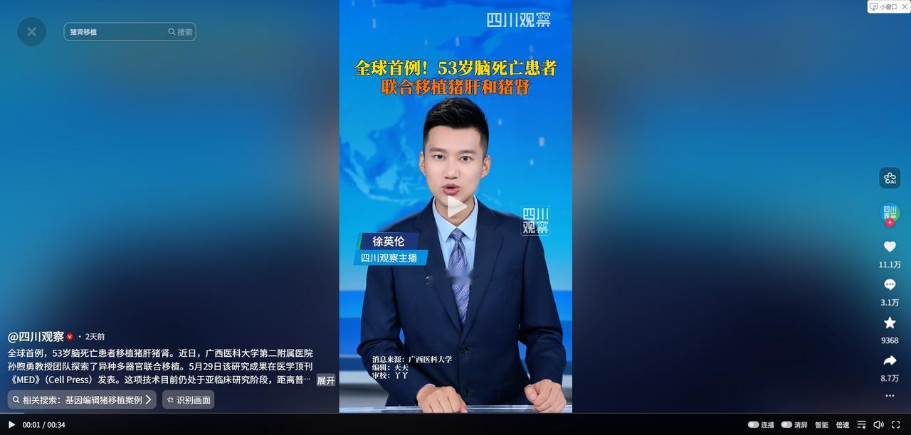 全球首例！广西一帮医生，居然把一整头猪的肝脏，连同两颗猪腰子，一次性移植到了一个