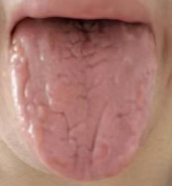 长期肾精耗损致机能不佳？温补肾阳、温化寒湿是关键







总是感觉宗筋起来