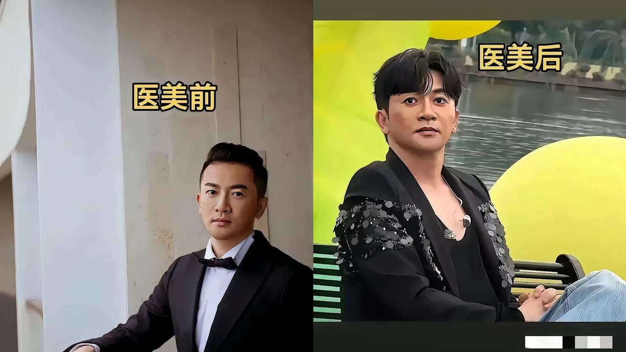 右图是现在的苏有朋？
天，完全不敢认。
听说好像是做了医美，还不太成功？真的找不