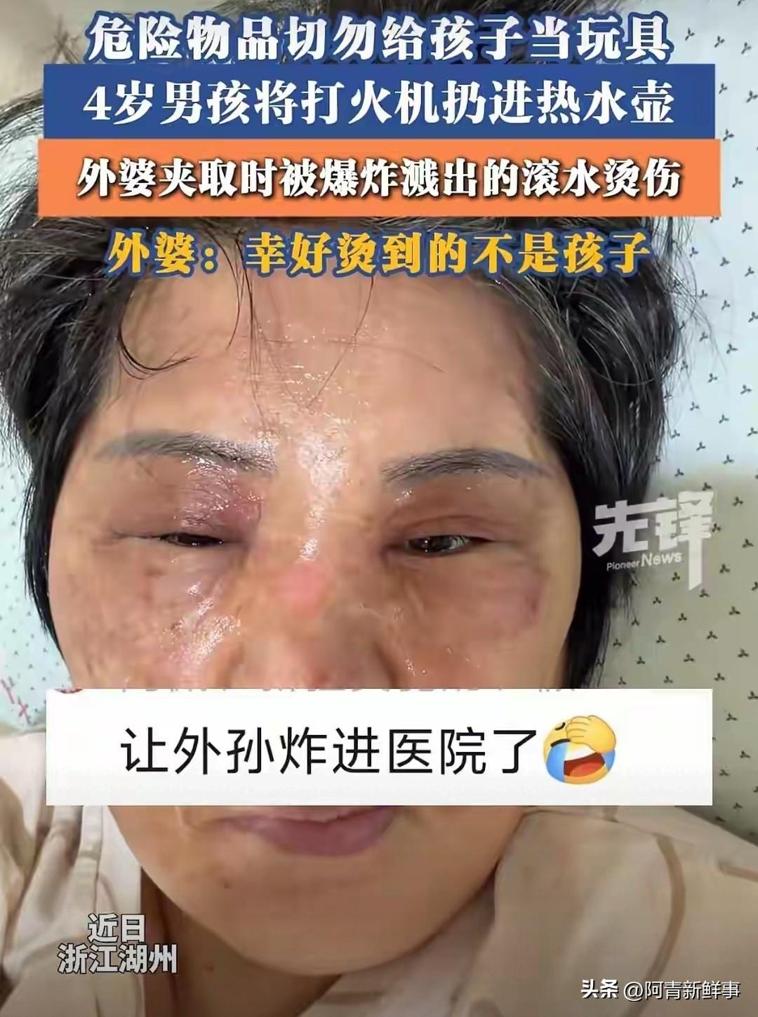 悲剧还是发生了！一4岁男孩趁大人不注意，把打火机扔进了刚烧开的热水壶里。外婆发现