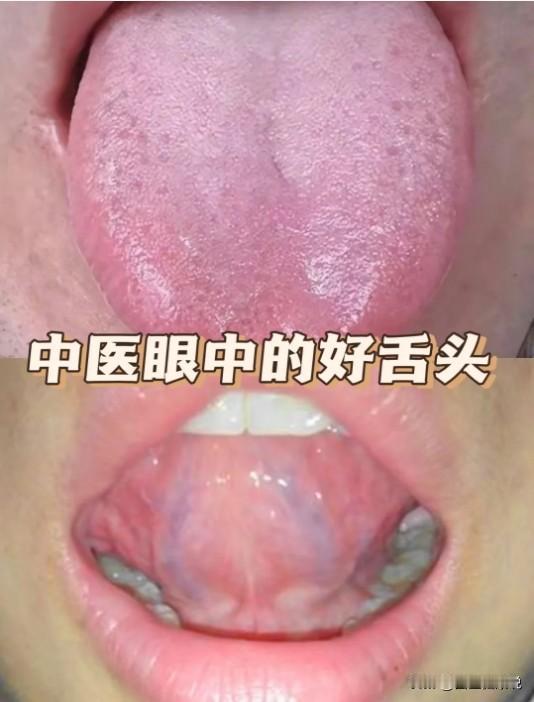 舌头不对劲的地方，往往就是身体的病
舌头能反映身体的情况，可以说是舌象就是身体的