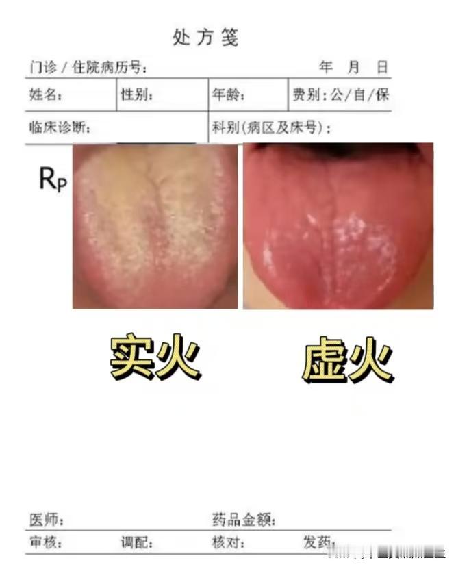 实火还是虚火，从舌头上就能看出来

不少朋友有这样的疑问，总是上火，但是分不清自