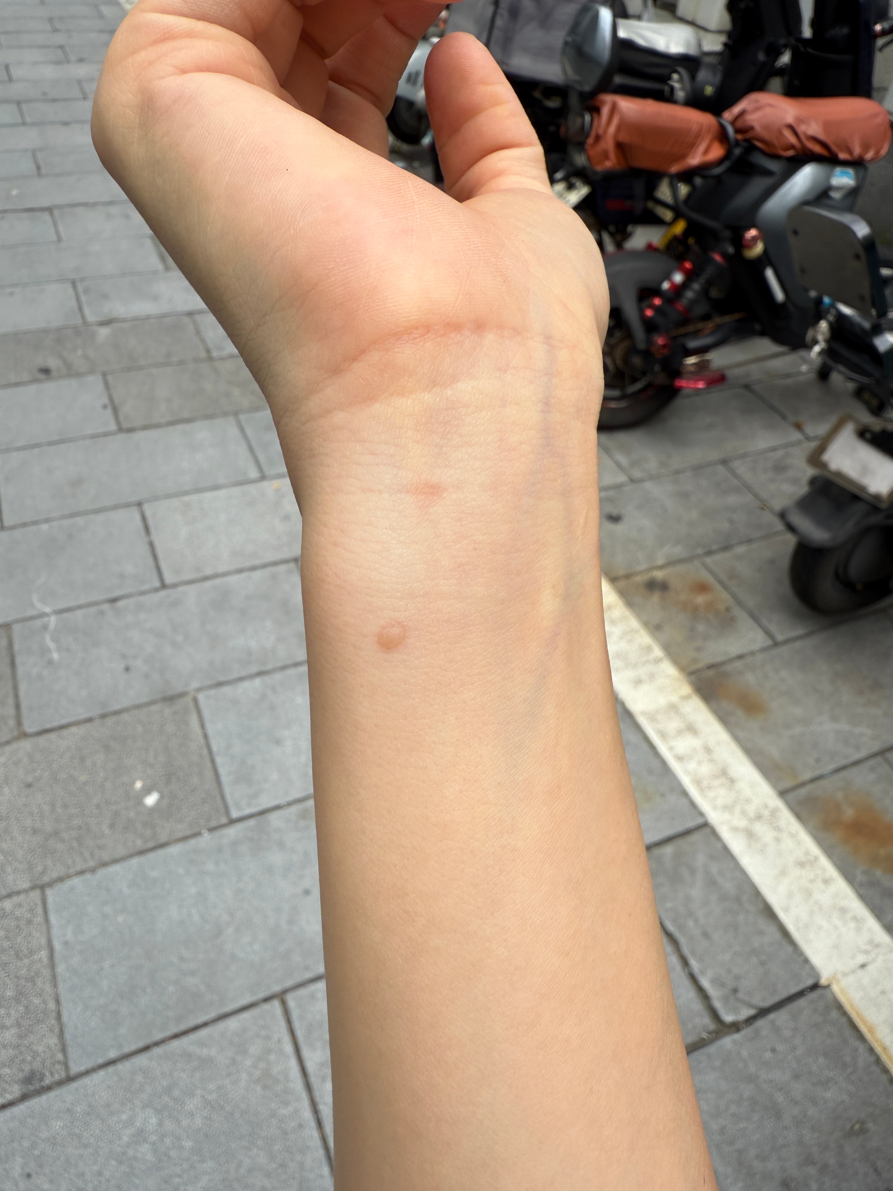 就烫起泡了(◍•﹏•) ​​​