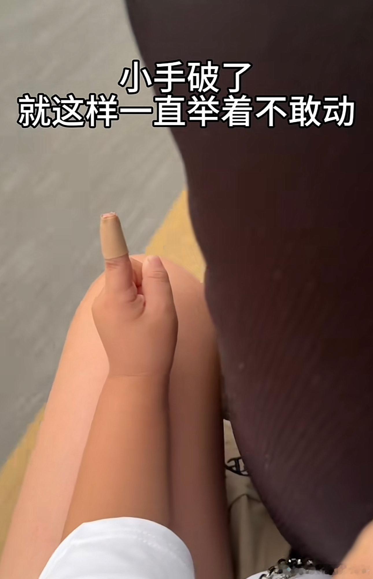 必须快点去医院，要不然一会伤口就愈合了 ​​​