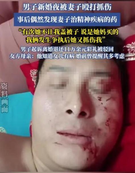 四川达州，洞房花烛夜，男子想与新婚妻子发生关系，结果被抓花脸。男子怀疑妻子另有新