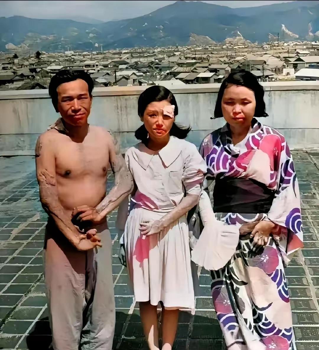 1945年，广岛原子弹爆炸后，三个幸存者，留下了这一张照片，镜头中的他们眼神非常