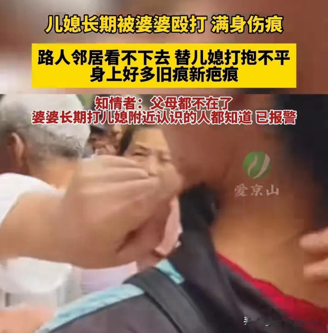 真嚣张！这婆婆真是太恶毒啦！一名婆婆长期打儿媳，导致儿媳身上新伤旧伤邻居都看不下