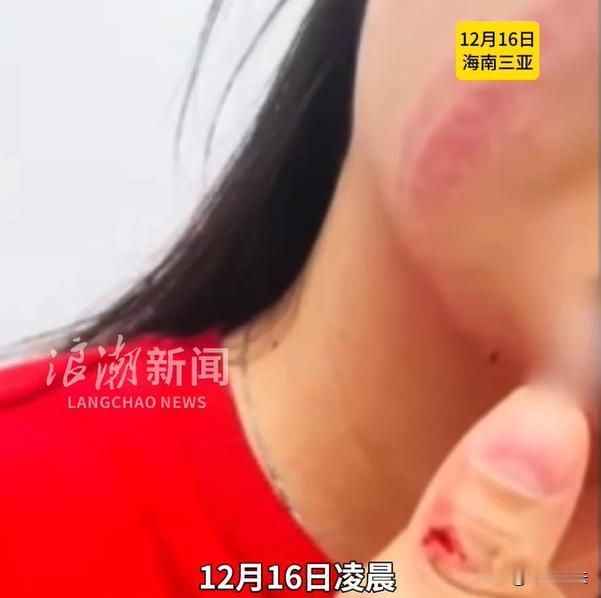 海南三亚，张女士凌晨跟朋友到一家饭店吃宵夜，二人坐在路边的大排档处边吃边聊。这时