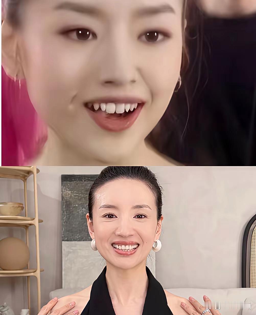 董洁对牙齿做了什么？ ​​​