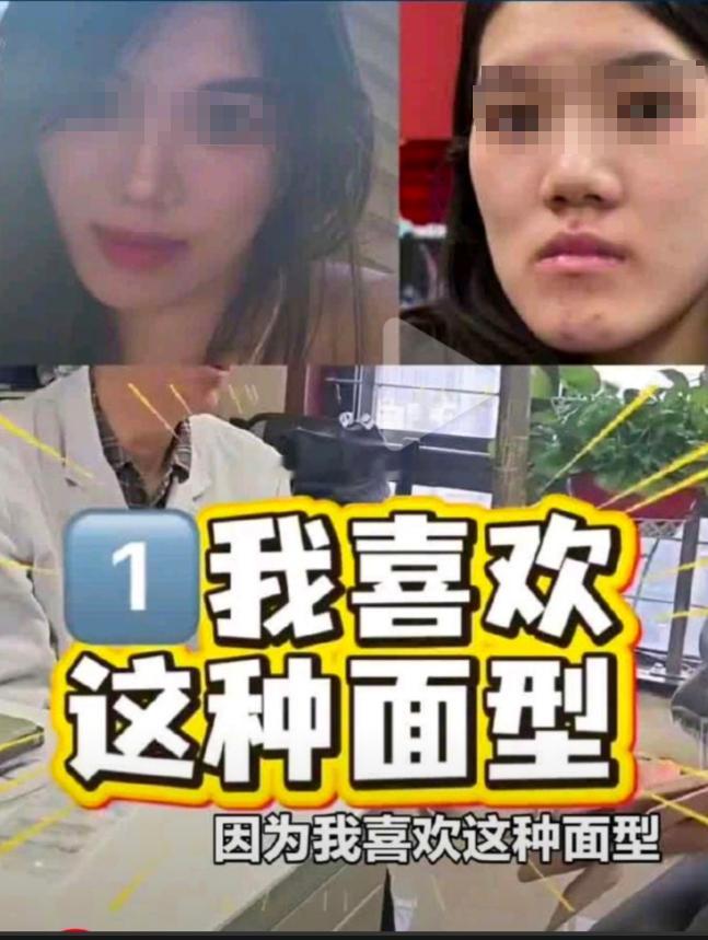 卫健委介入24岁女孩正颌手术被做反 离谱至极！24岁女孩正颌手术被做反，医生：更