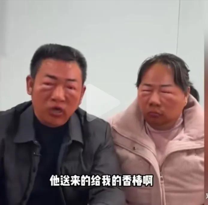 夫妻俩误把漆树芽当香椿吃，导致过敏，俩口子全脸浮肿，连眼睛都肿的睁不开了。
男子