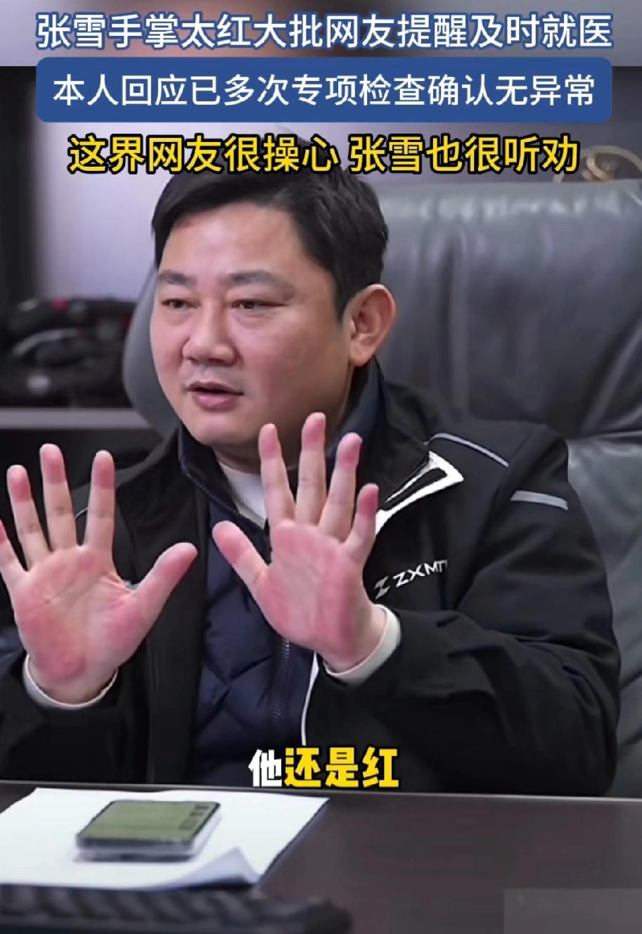 你们的手掌会是什么颜色？[吃瓜群众]