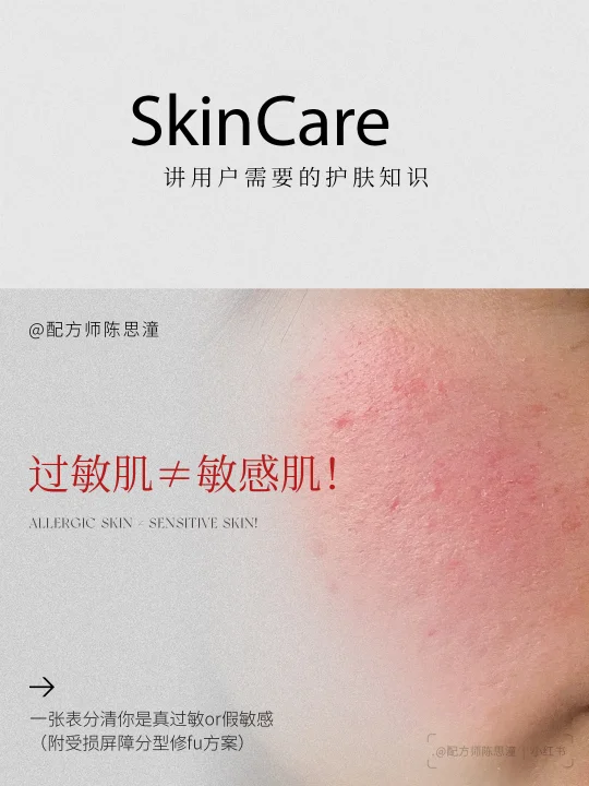 护肤知识｜敏弱肌是天生的吗？能否彻底痊愈