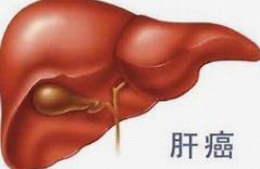 67岁大爷肝癌晚期，回家后大鱼大肉，坚决不治疗：不想人财两空！

在我们这个社会