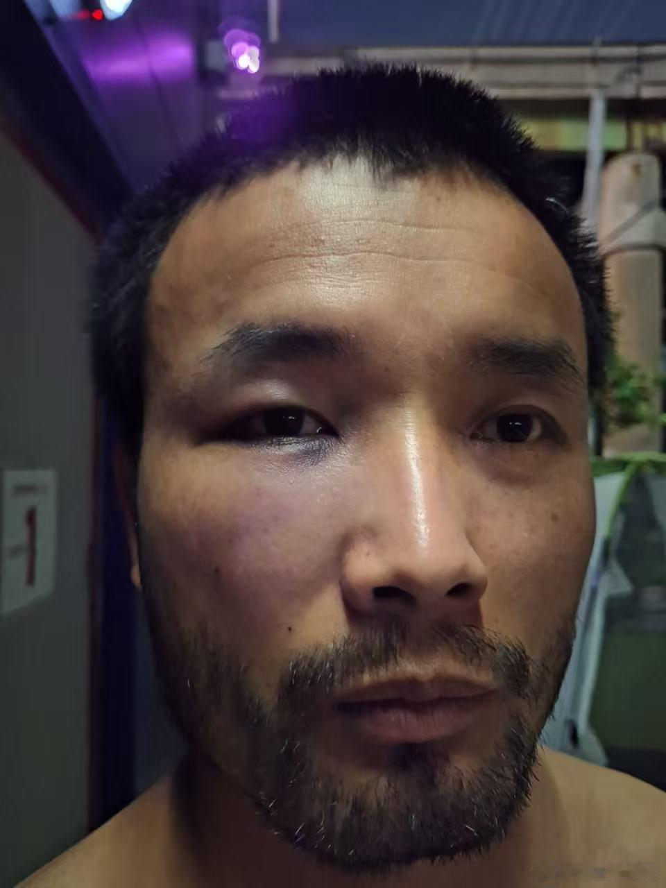唉，陈旺又又又又让人给揍了这一次被人揍的无眼雀青...电子宠物海外新鲜事