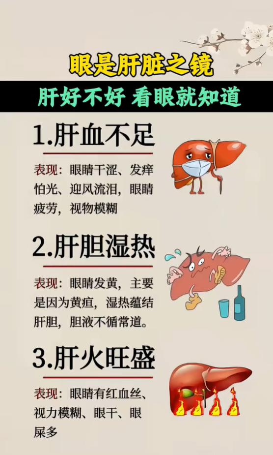 中医讲 “眼为肝之镜”，从眼部表现分辨肝血不足、肝胆湿热与肝火旺盛