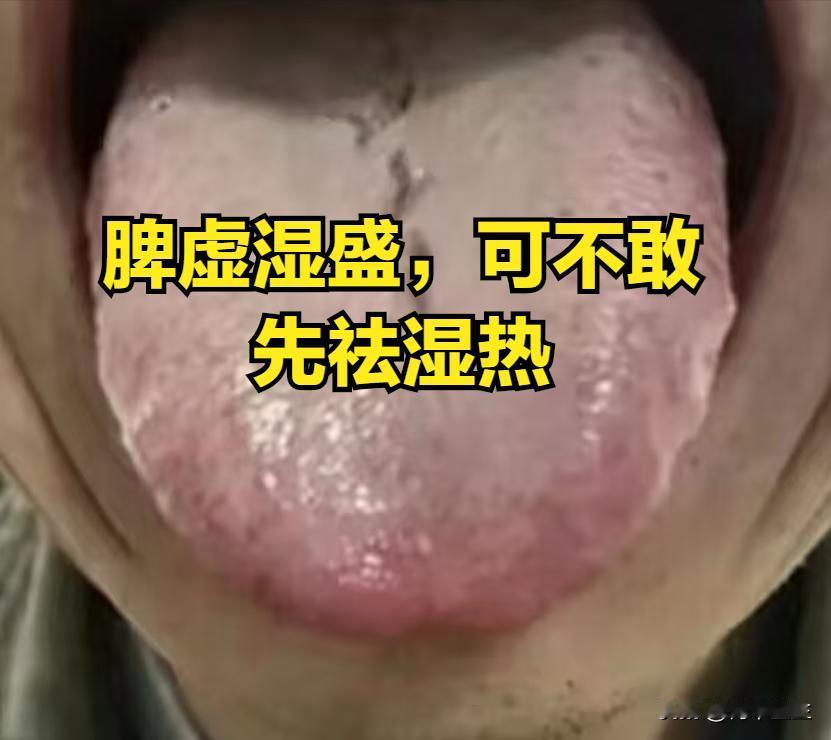 朋友，你这个舌头就别清湿热了，你这越清越湿，知不知道，听我一句劝，先把你的脾胃补