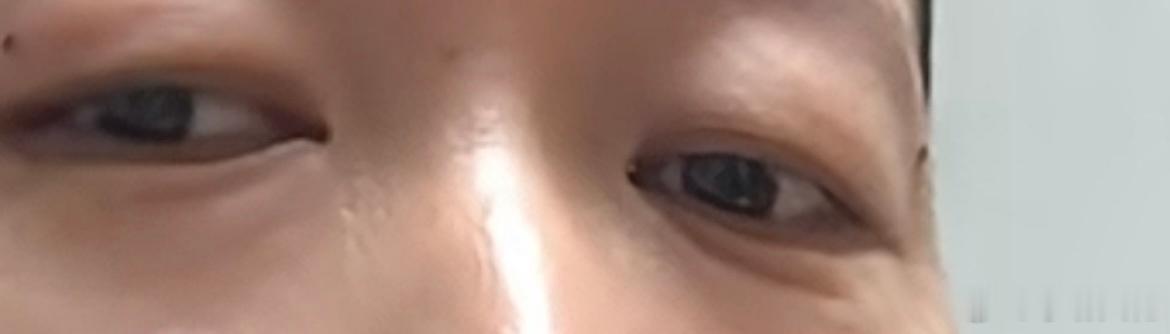 面相一则：[并不简单]眼睛耷拉（如图）眼尾往下走，且没有卧蚕的，这样的人不要投资