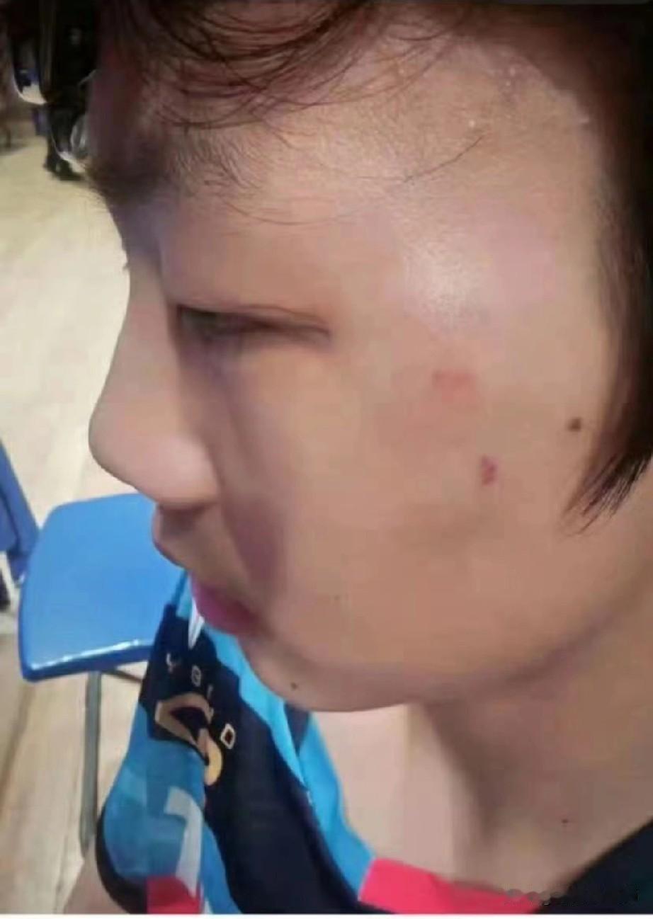 14岁就这么戾气，
以后长大了怎么得了？
打个乒乓球输了比赛，
就拳脚相加，
将