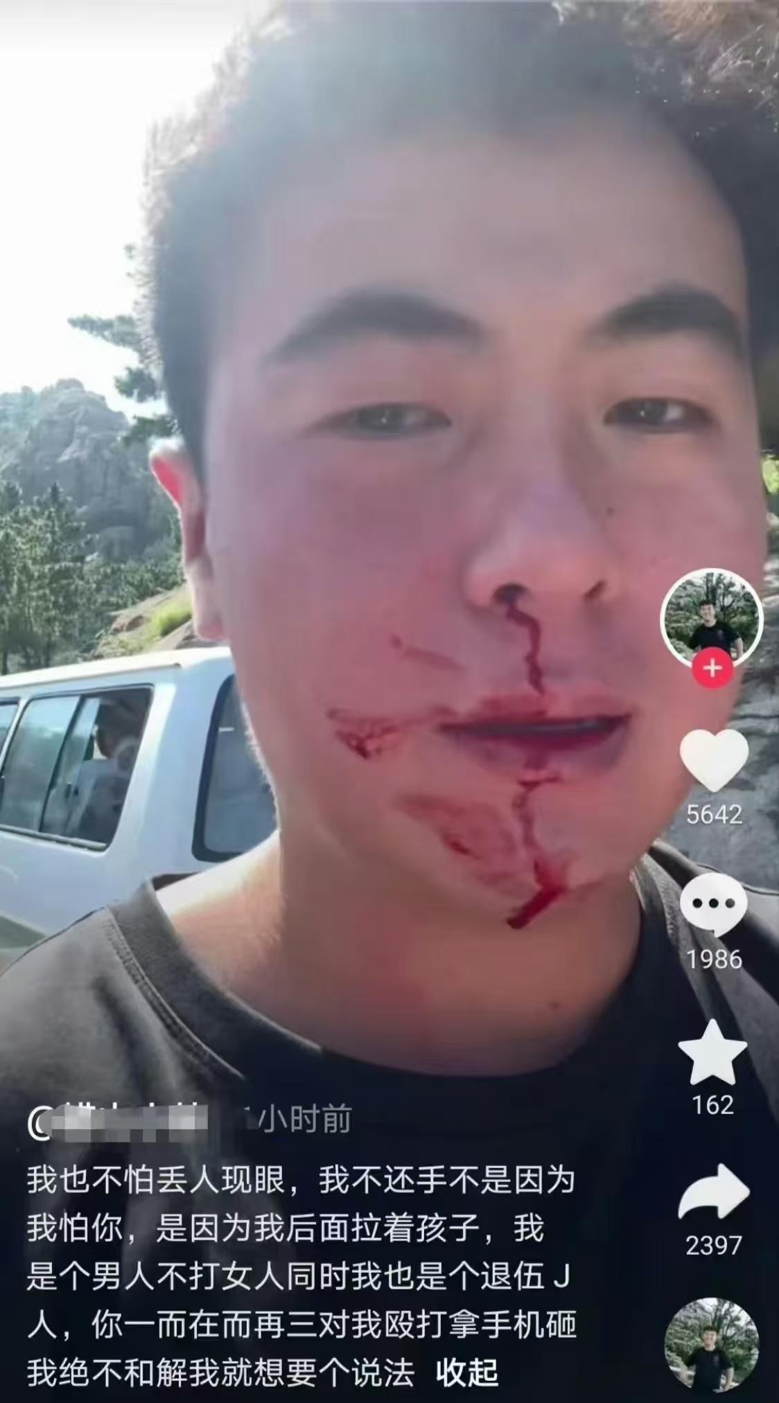一声叹息

人们常说，法律会迟到，但不会缺席。
但是，面对赤手空拳就能够把一名退