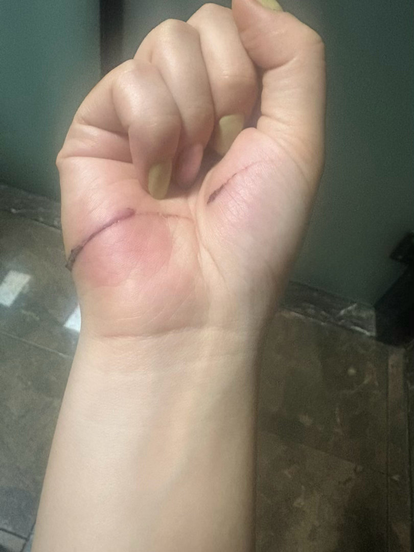 前天蛐蛐完美甲差不多过半小时就摔了一跤，手划到了还好今天不咋痛了下次我要当面说美