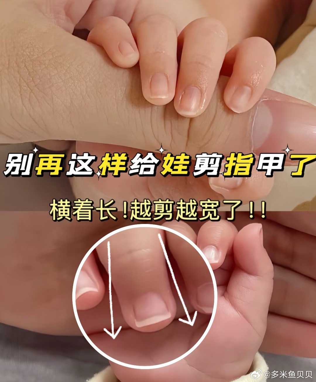 宝宝剪指甲的方法，别剪越宽了 