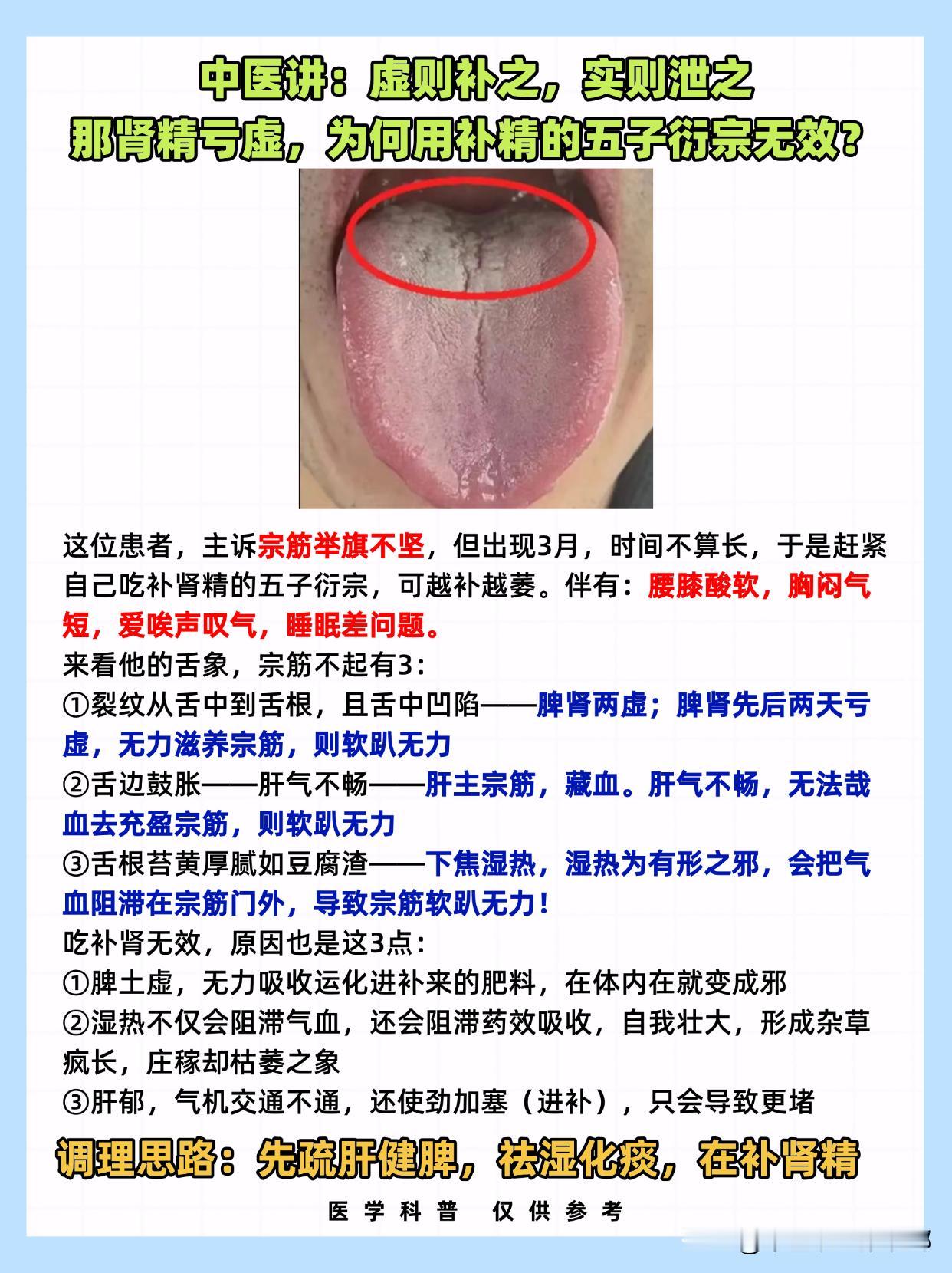 中医讲：虚则补之，实则泄之，那肾精亏虚，为何用补精的五子衍宗无效？