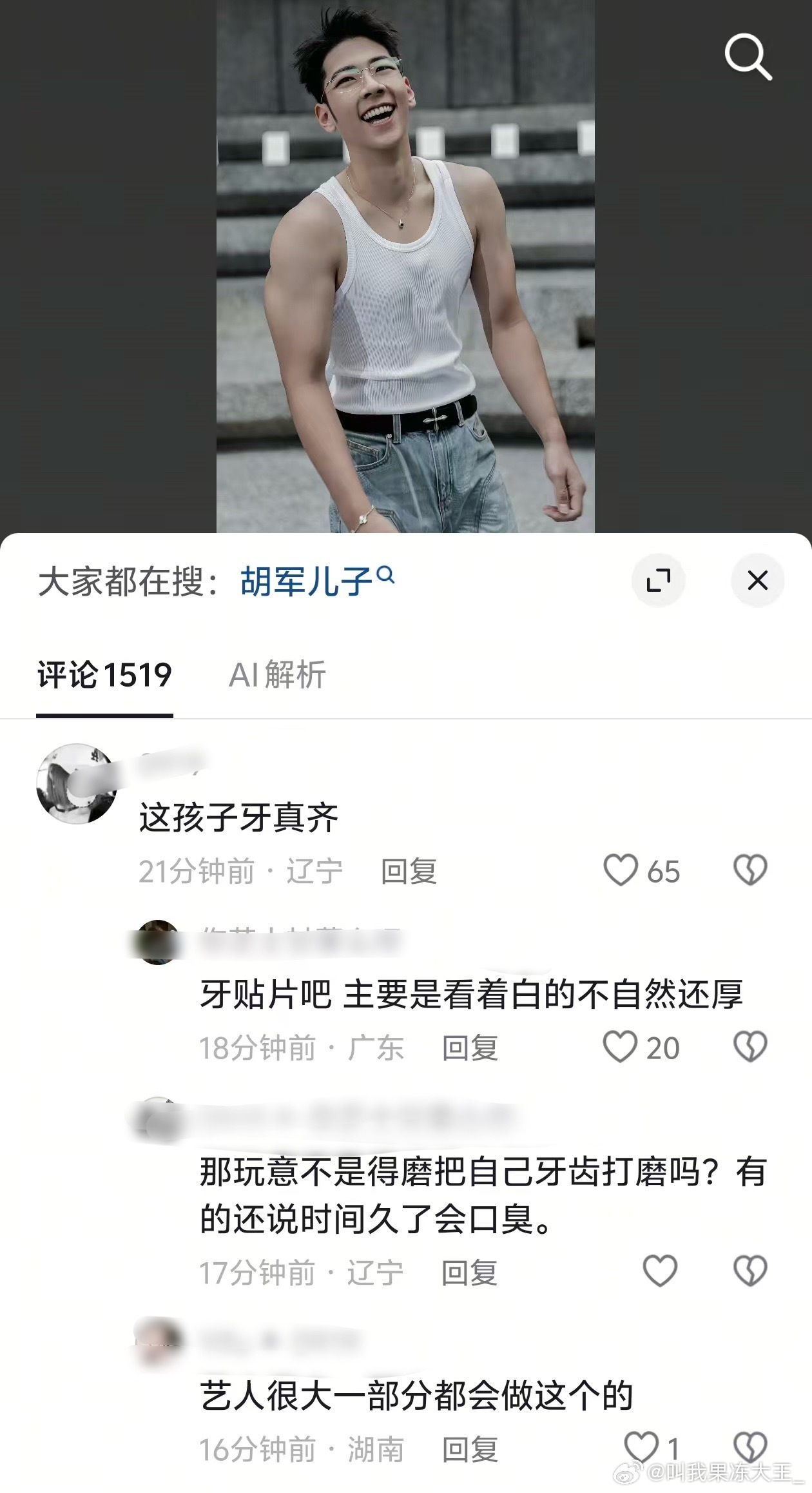 郭涛儿子的牙好齐，网友怀疑做了牙贴片郭涛儿子的牙好齐郭涛儿子疑似做了牙贴片 ​​