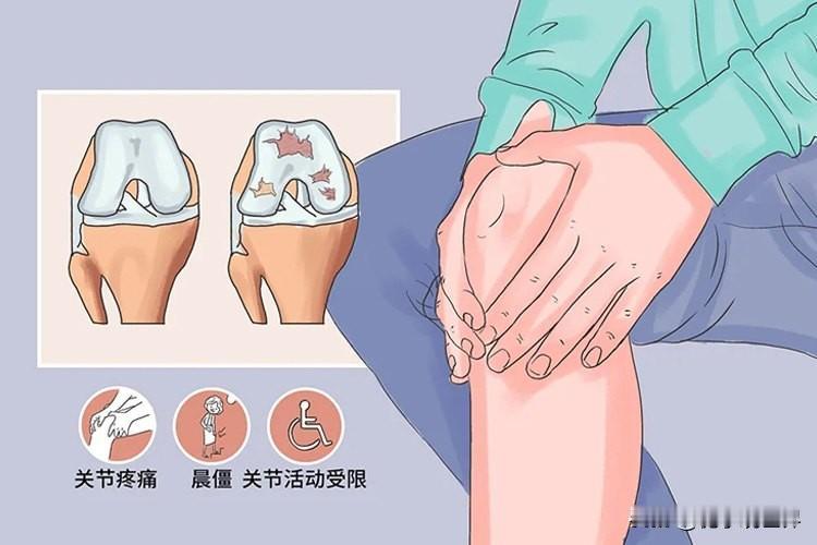 做好饮食调节，对延缓老年性关节炎的进展、提高生活质量有帮助。
       昨天