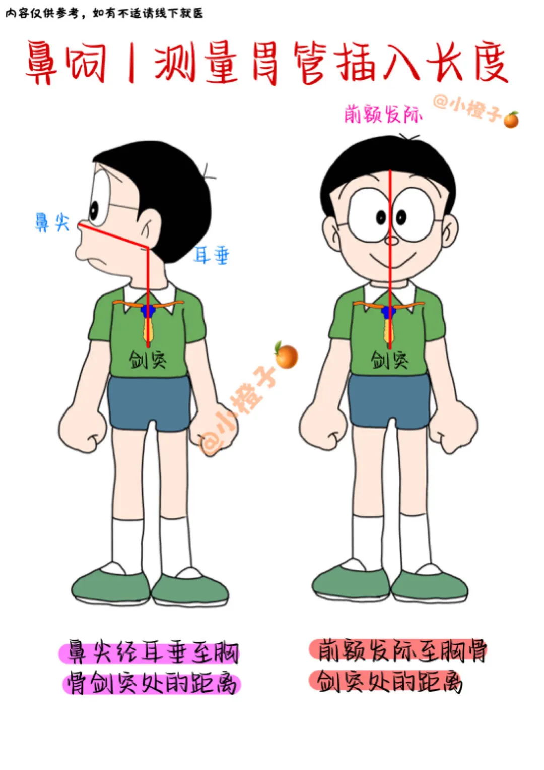 📖基础护理学笔记｜鼻饲操作法｜建议收藏