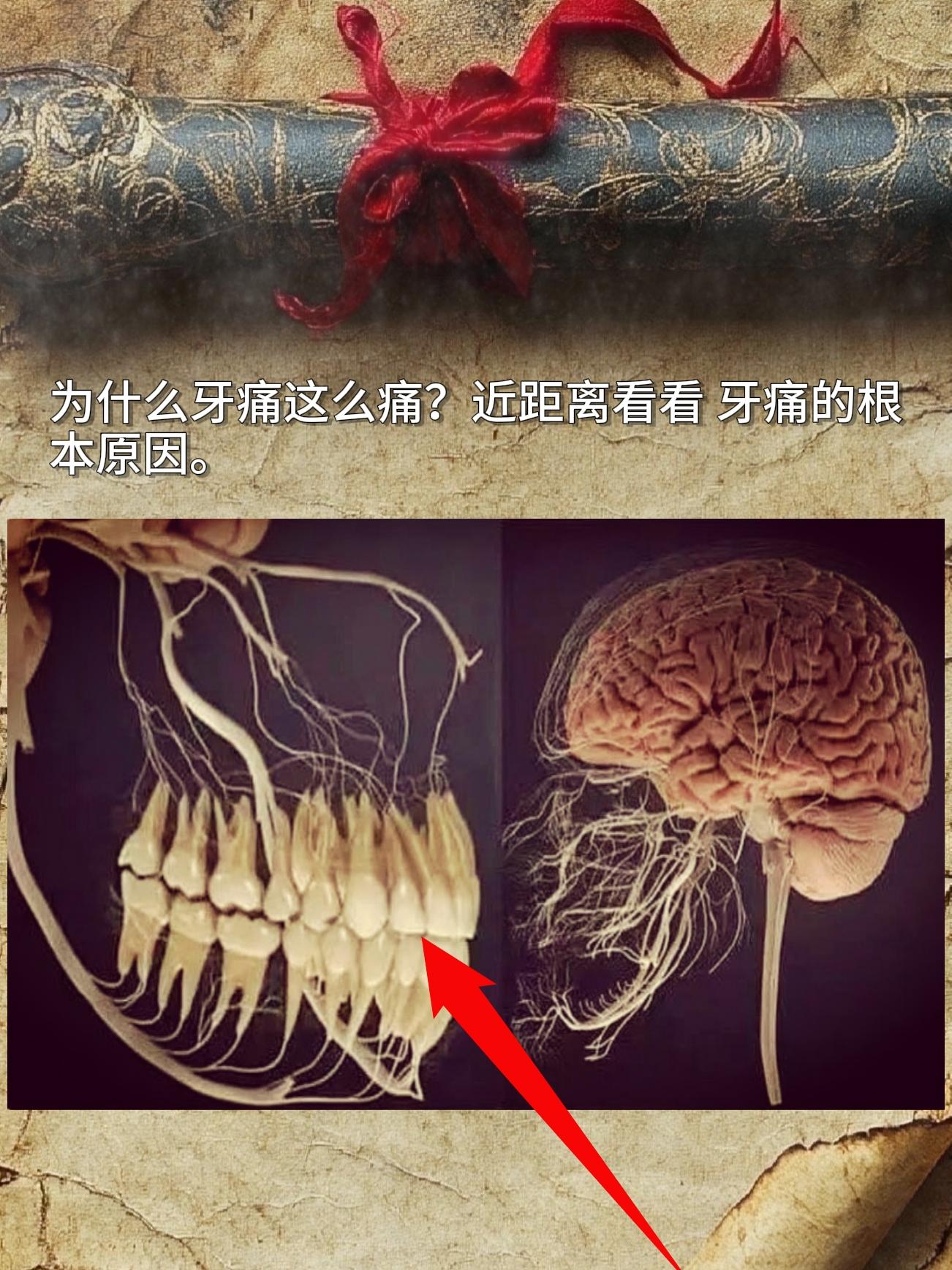 为什么牙痛这么痛？近距离看看牙痛的根本原因