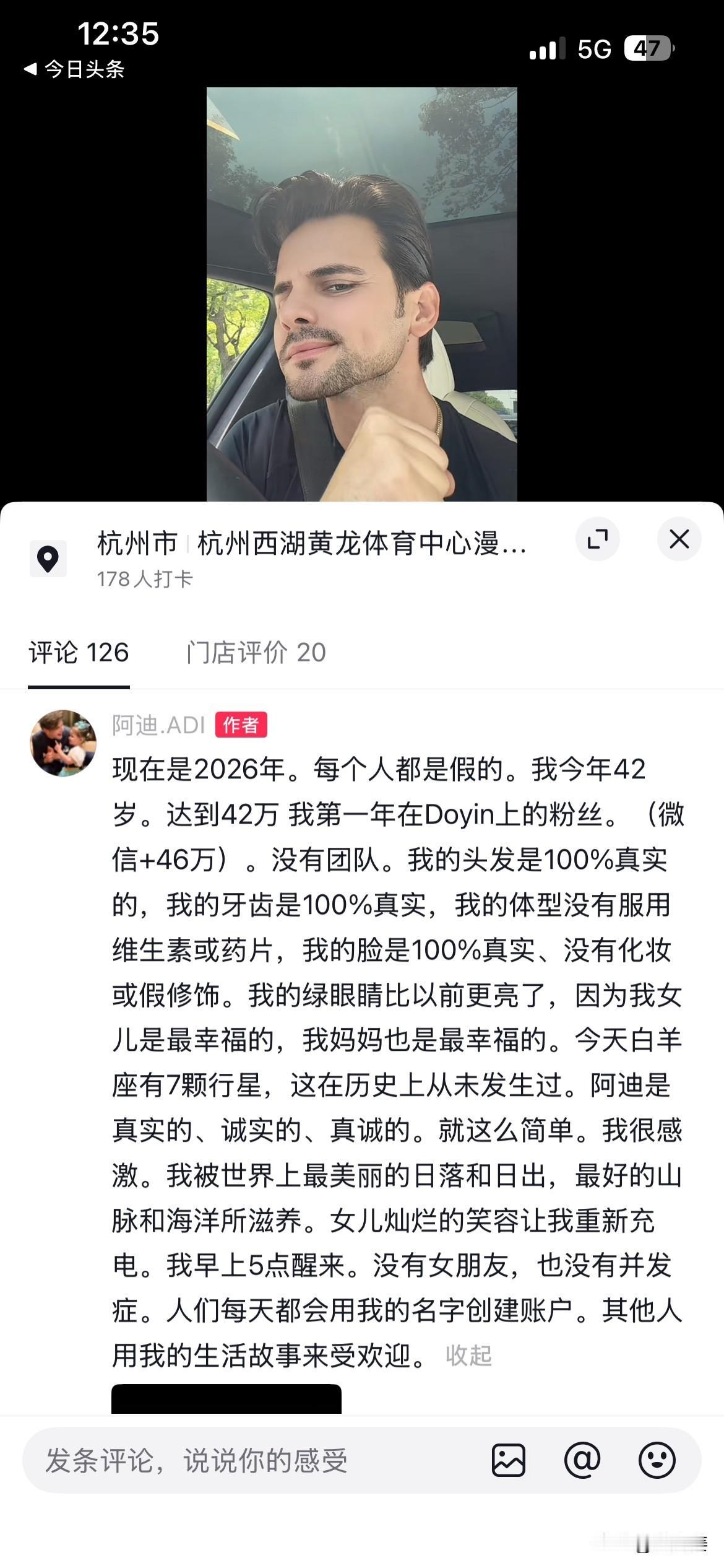 20260419
公主失恋了，阿迪却说他是真实的。他敲敲左脸再敲敲右脸，表示自己