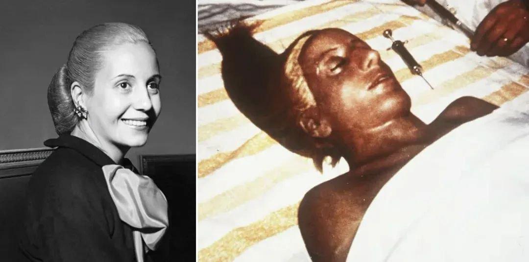 伊娃·庇隆（Eva Perón）于1952年去世，年仅33岁。她那具经甘油防腐处