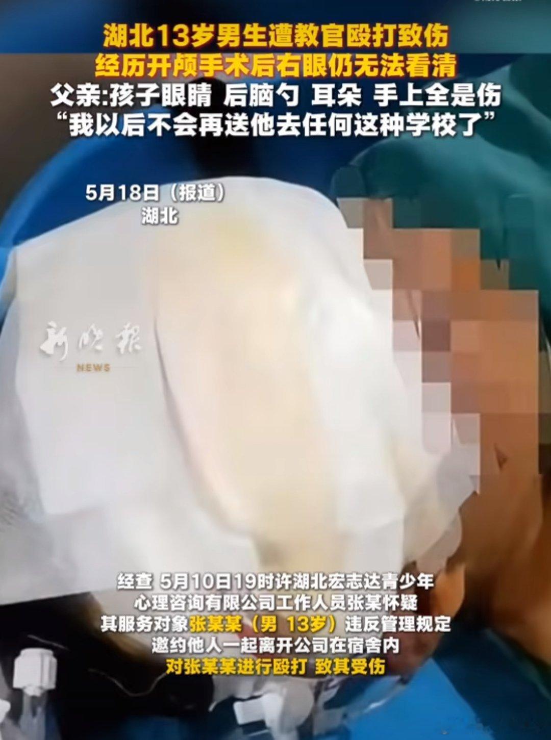 教官殴打13岁男孩致右眼失明岁的张浩被父亲花费3.28万元送入湖北阳新县宏志达青