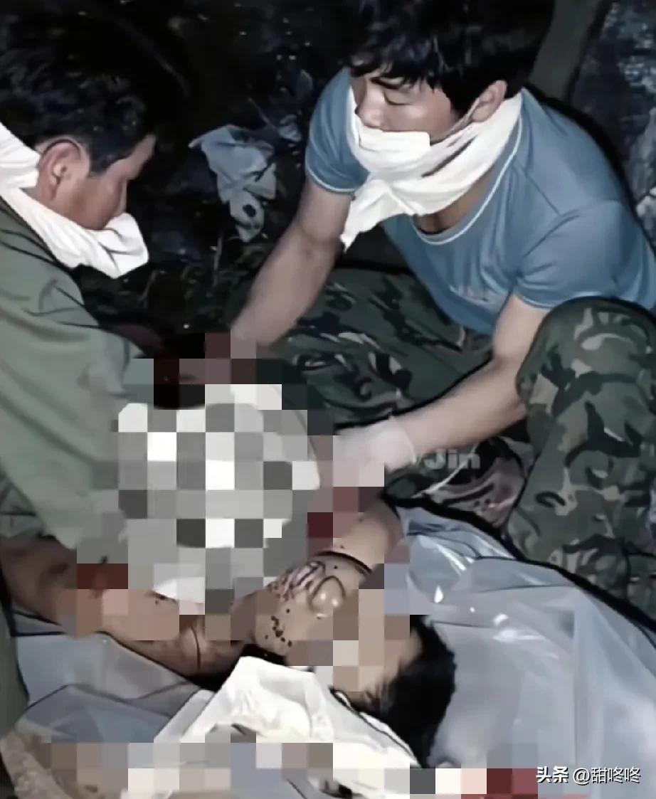 1985年，老山战场的后方救护所里，一名战士在战斗中被敌人的炮火击穿胸部，肠子都