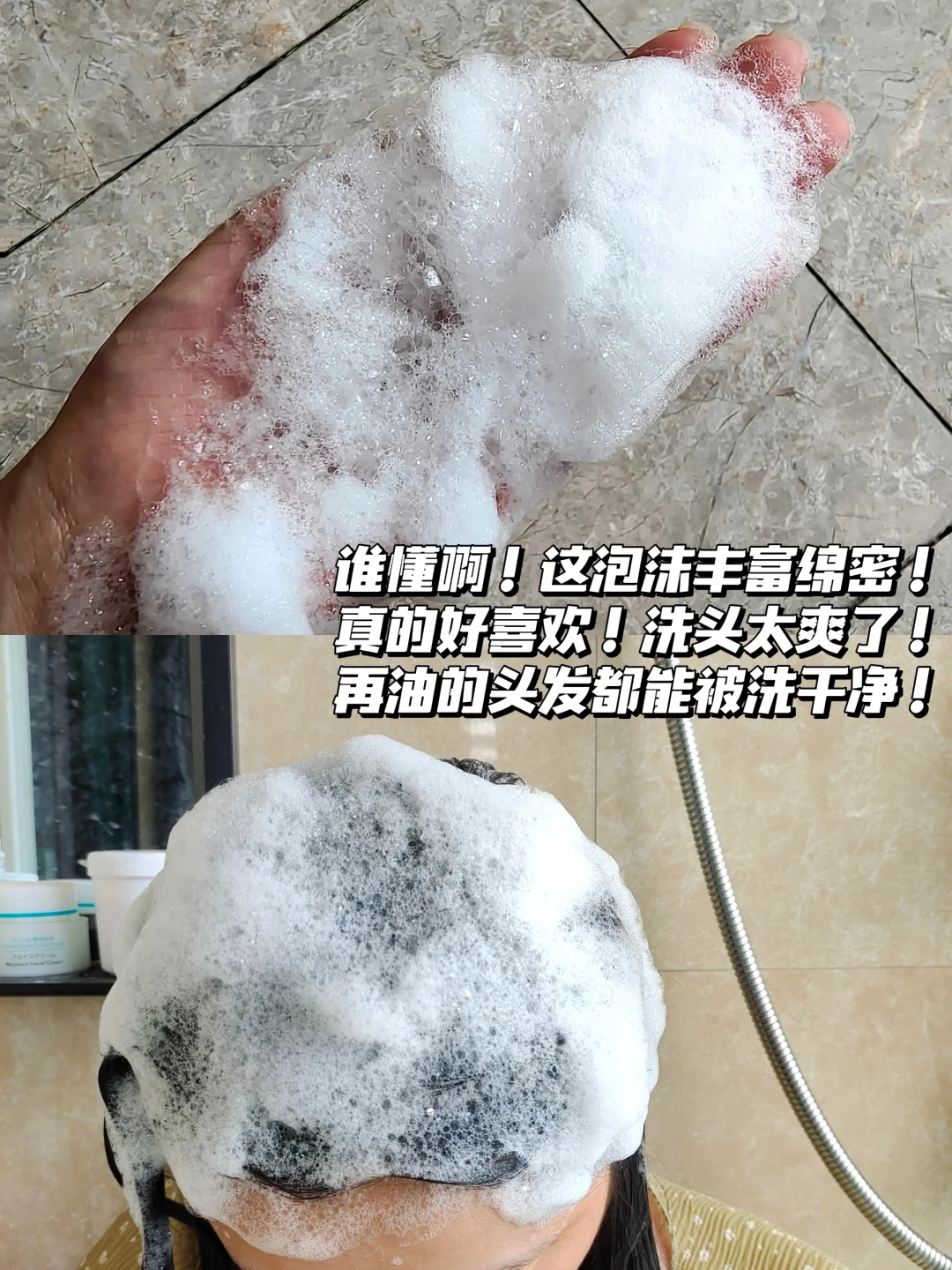 脱发原因大不同，防错了等于白防