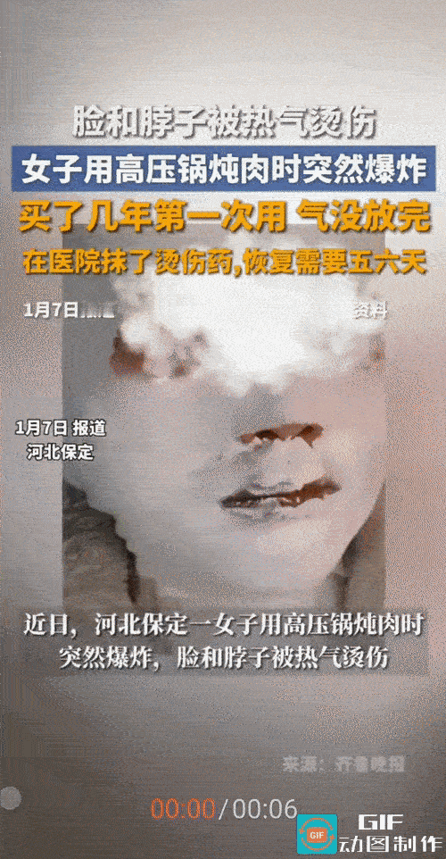 “高压锅变‘炸弹’？”河北保定，女子在家用高压锅炖肉时，见高压锅上面的小红盖掉下