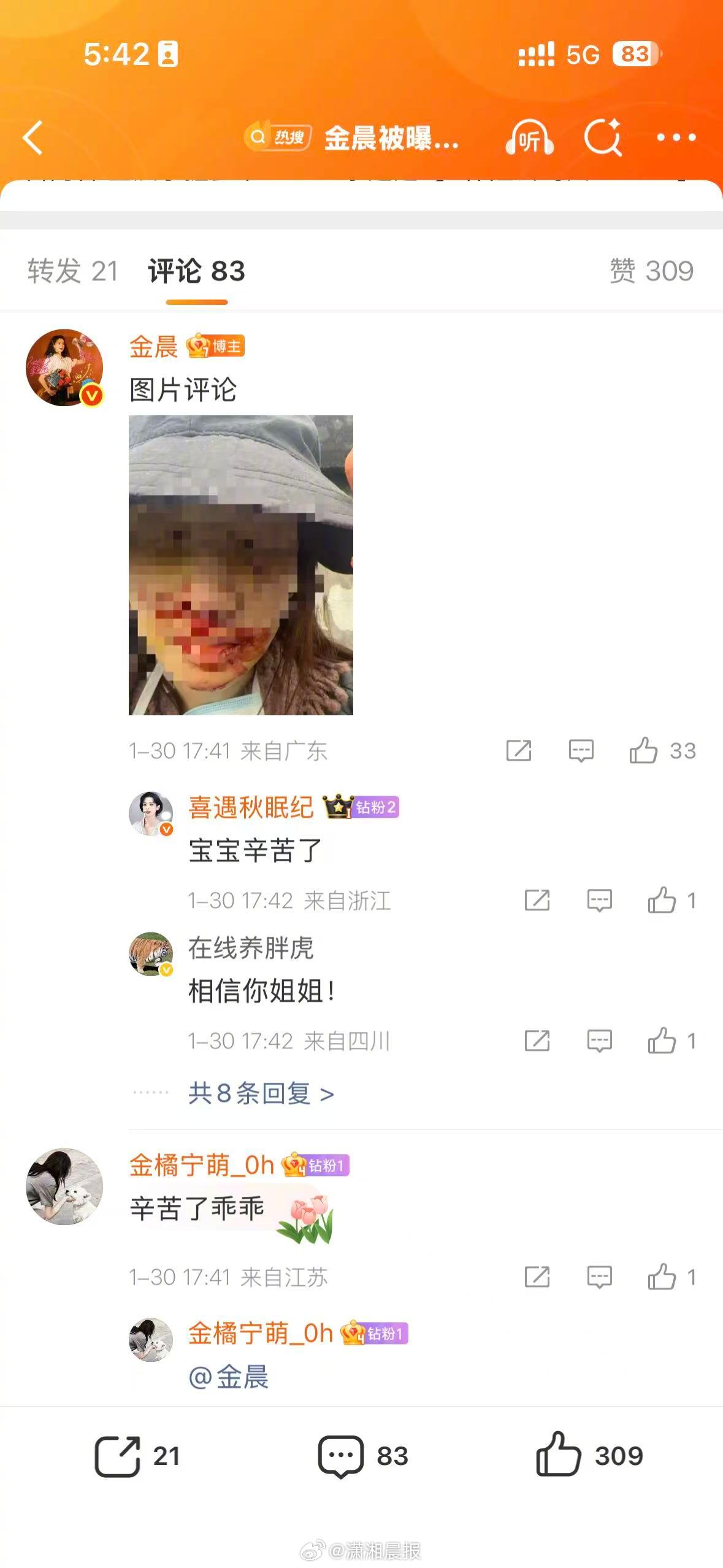 【#金晨晒事故受伤照#】 1月30日，发文，并在评论区晒出事故受伤照。原文如下：