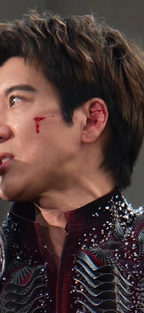 王力宏摔倒 我的天呐！ 受伤这么严重，还继续演唱，二哥辛苦了