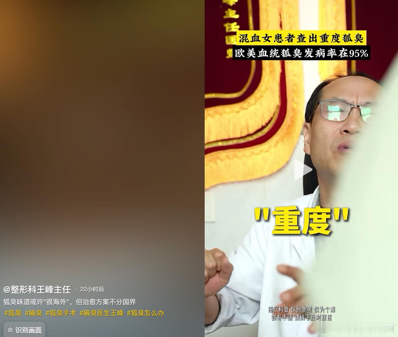 混血儿的狐臭是跑不了的，串串就是串串。 