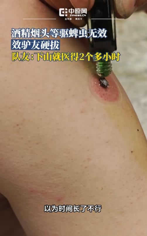 真的奉劝各位爬山别轻敌！皖南徒步老哥惨遭蜱虫死死扎根，酒精风油精烟头烫全没用，越